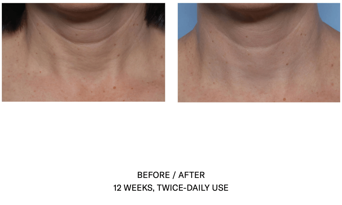 Techno Neck Perfecting Cream