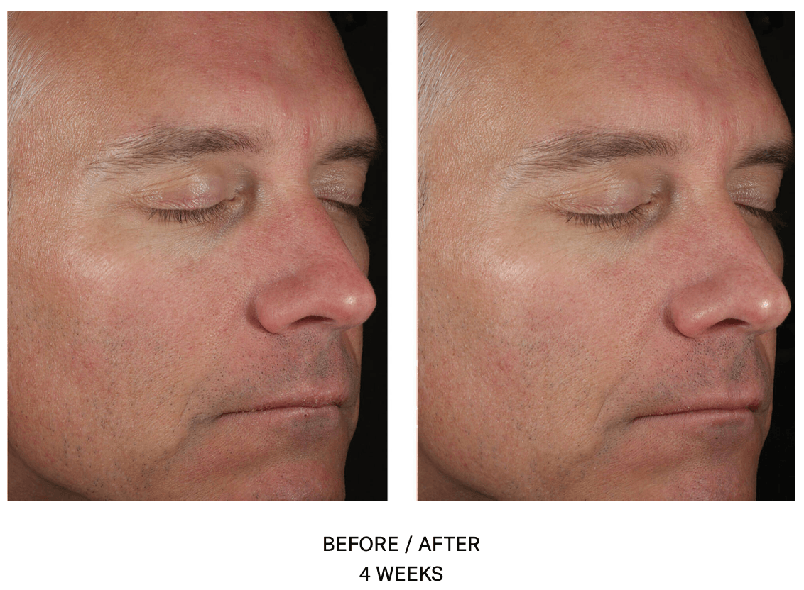 Solo Hydrating Defense MEN