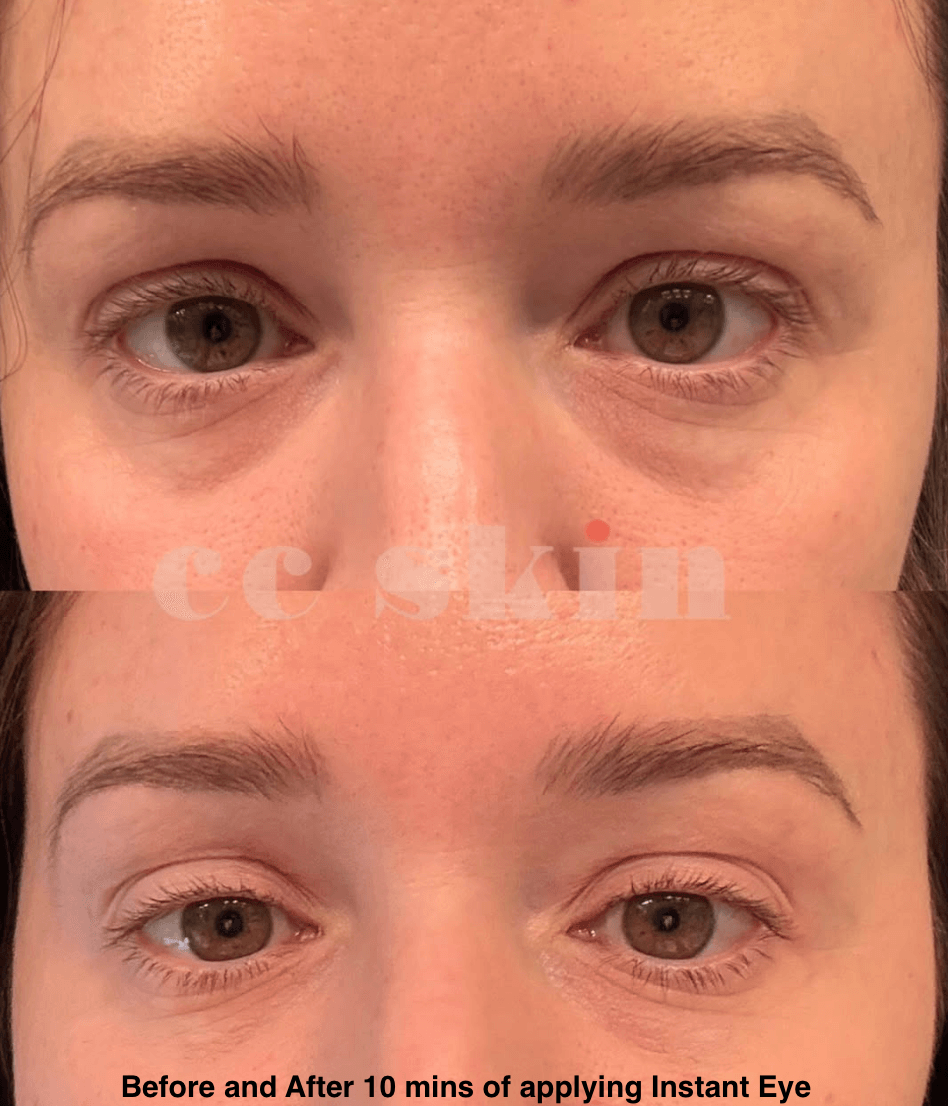 Instant Effect Gel EYE
