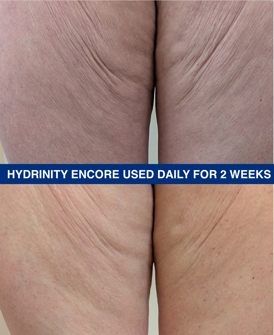 Encore Body Hydrator