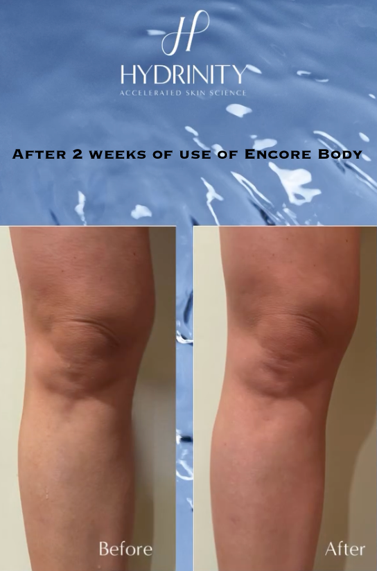 Encore Body Hydrator